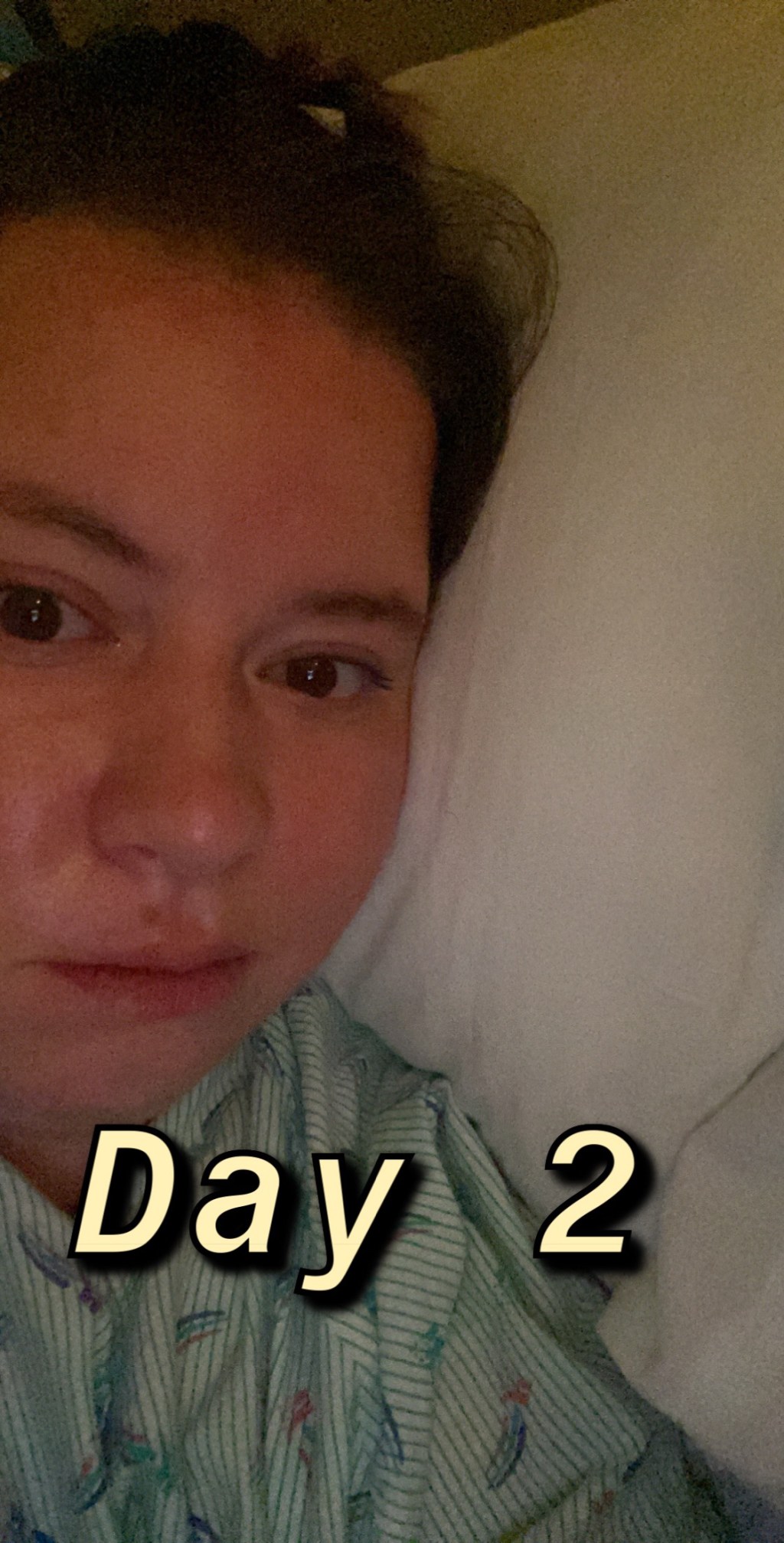 Day After Surgery-&nbsp;8/21/2020